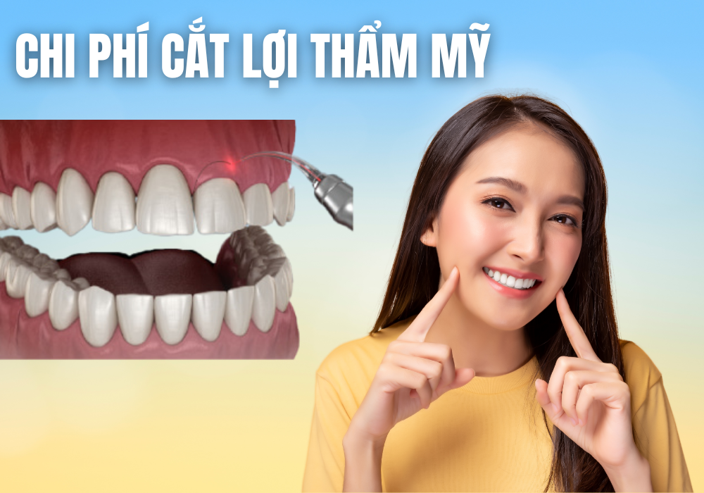 Chi phí cắt lợi thẩm mỹ không đơn thuần là để làm đẹp, mà còn góp phần bảo vệ sức khỏe lâu dài