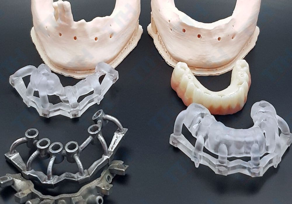 Bác sĩ thực hiện phẫu thuật Implant, quy trình chuẩn xác và an toàn trong môi trường vô trùng.