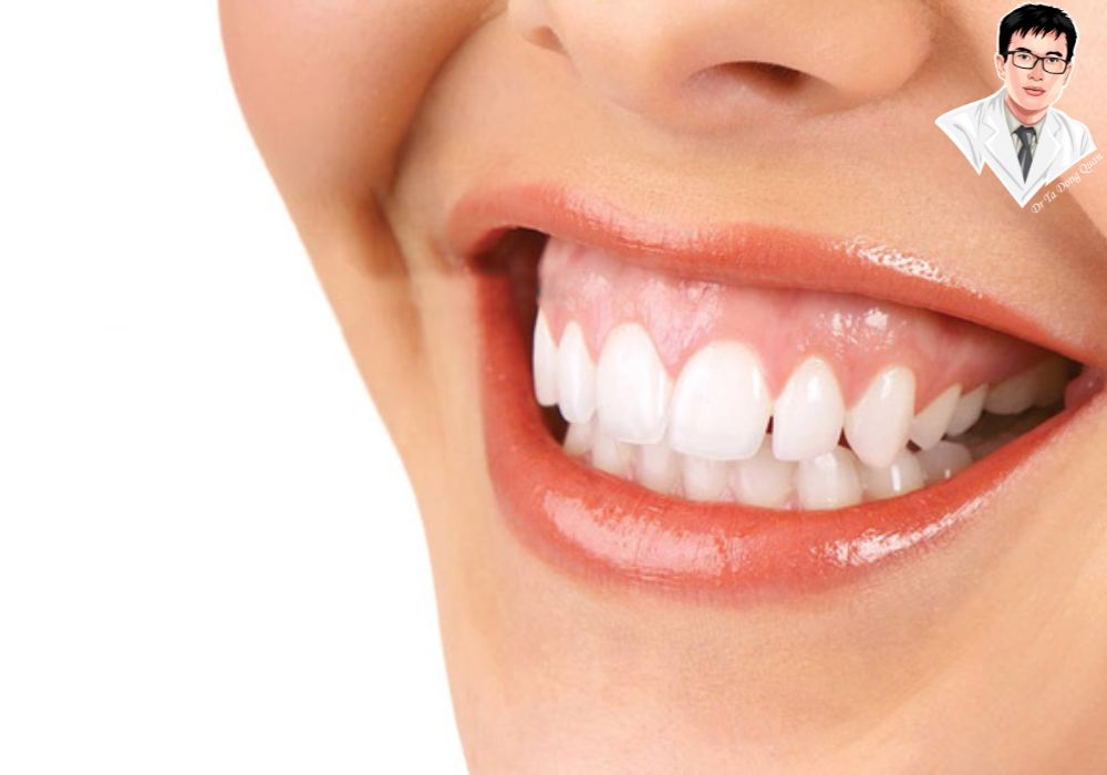 Cắt lợi – Giải pháp hiệu quả cho người bị cười hở lợi.