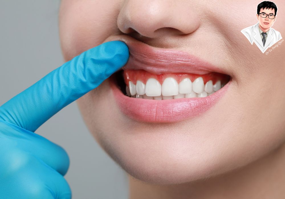 Người phụ nữ cười tươi, kiểm tra vùng lợi kỹ lưỡng – biểu tượng của dịch vụ cắt lợi thẩm mỹ	