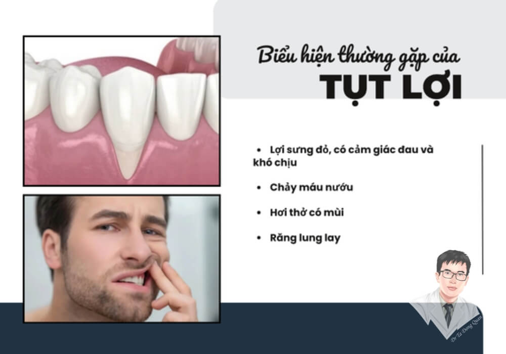 nfographic về các dấu hiệu thường gặp của tụt nướu răng như lợi sưng đỏ, chảy máu khi chải răng, hơi thở có mùi hôi và răng lung lay.