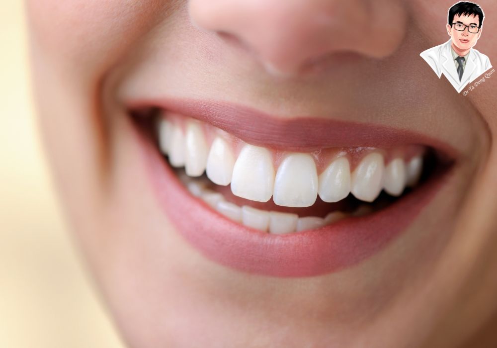 Nụ cười tự tin và sức khỏe răng miệng được nâng cao sau phẫu thuật cắt lợi.