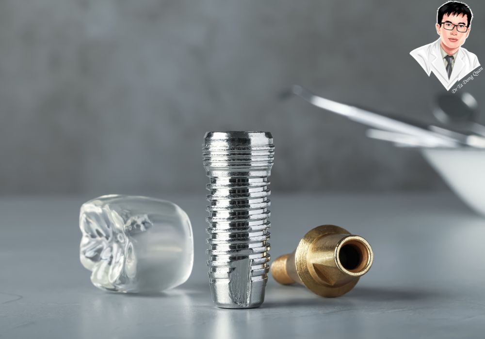 Phục hình implant răng thẩm mỹ, khôi phục chức năng ăn nhai tự nhiên.