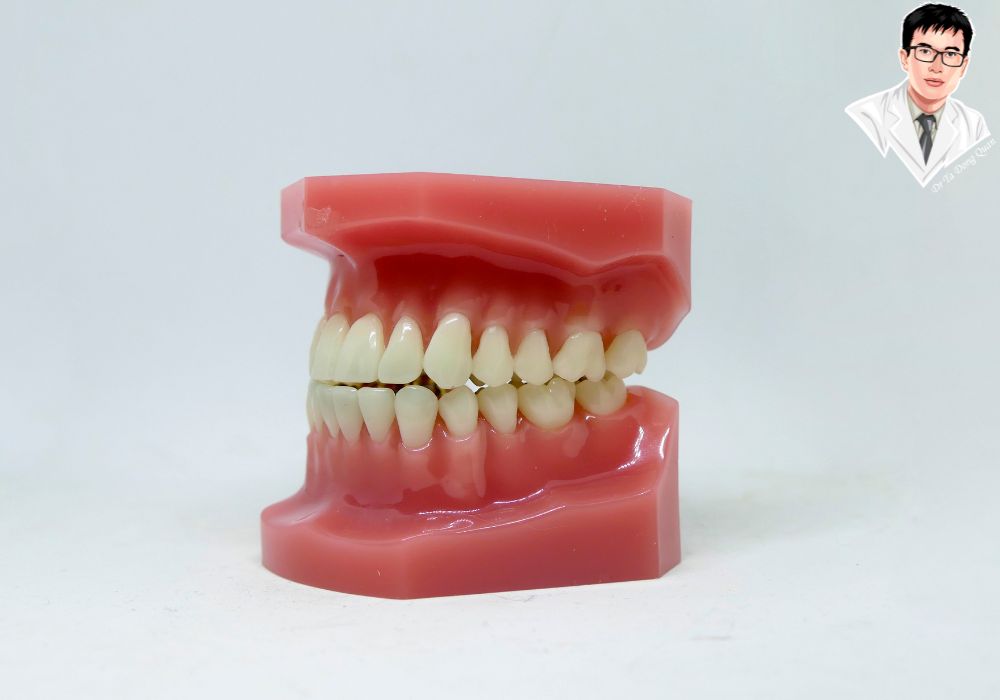 Cấu trúc răng và nướu chuẩn đẹp sau phẫu thuật cắt lợi thẩm mỹ giúp tăng tính thẩm mỹ và bảo vệ sức khỏe răng miệng.