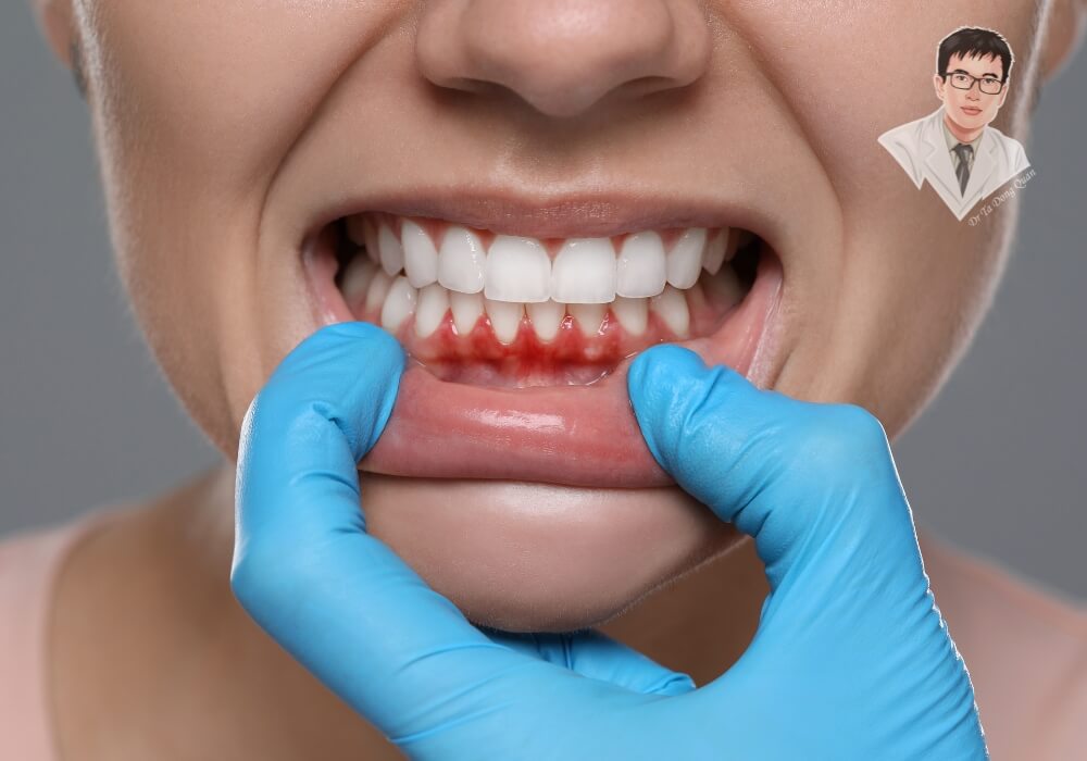 Bí quyết chữa tụt nướu giúp bạn lấy lại nụ cười tự tin! Nụ cười rạng rỡ với hàm răng trắng sáng, nướu khỏe mạnh sau khi điều trị tụt nướu thành công. Hình ảnh cho thấy sự cải thiện đáng kể so với tình trạng ban đầu.