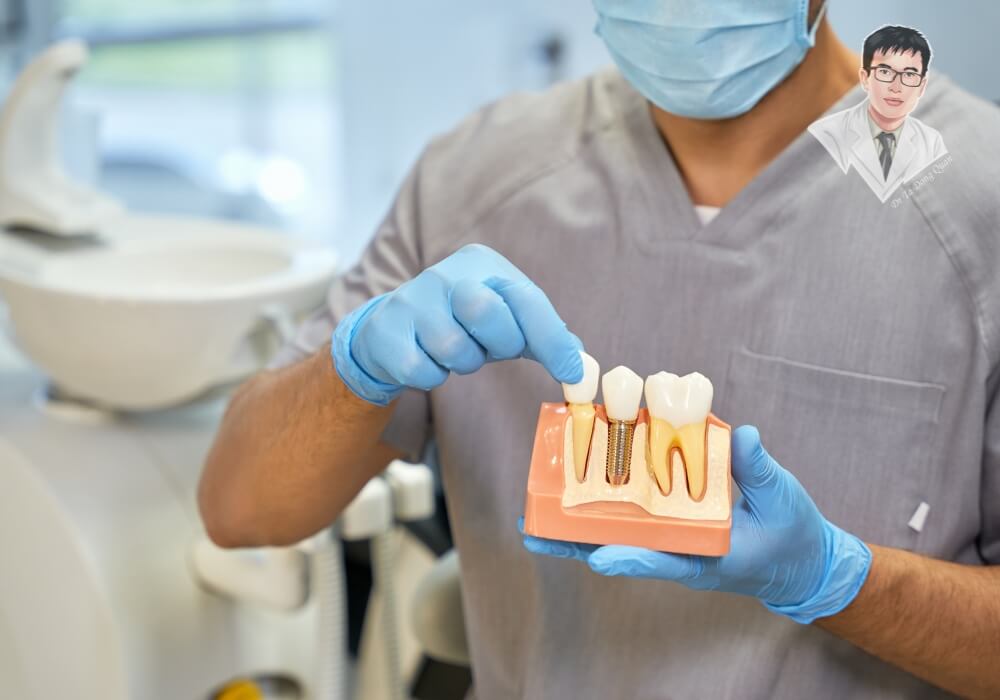 Hình ảnh bác sĩ đang thực hiện thủ thuật cấy ghép răng Implant cho bệnh nhân tại phòng khám nha khoa.