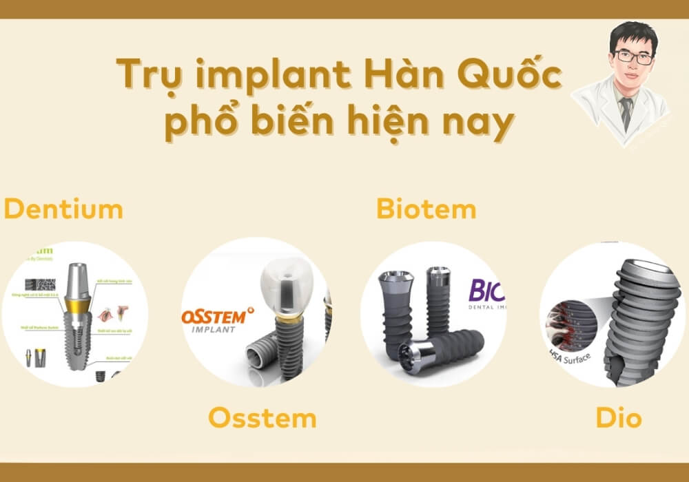 Hình tổng hợp các dòng trụ implant Hàn Quốc phổ biến như Dentium, Biotem, Osstem, Dio... phù hợp với đa số người dùng Việt.