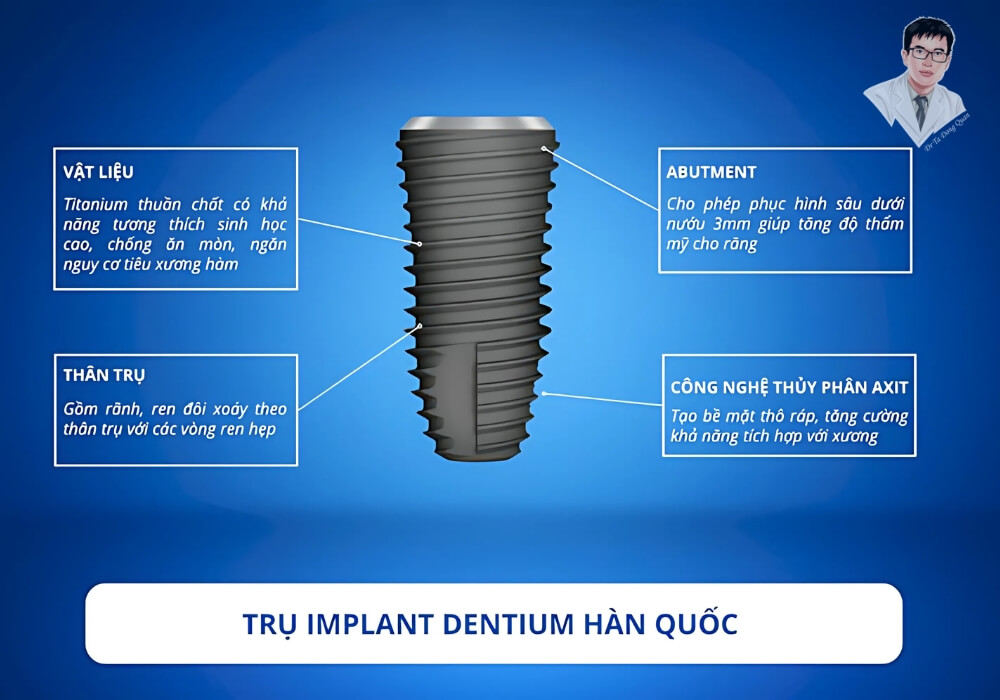 Trình bày cấu tạo chi tiết trụ implant Dentium Hàn Quốc với đặc điểm về vật liệu, ren xoắn và khả năng tích hợp xương.