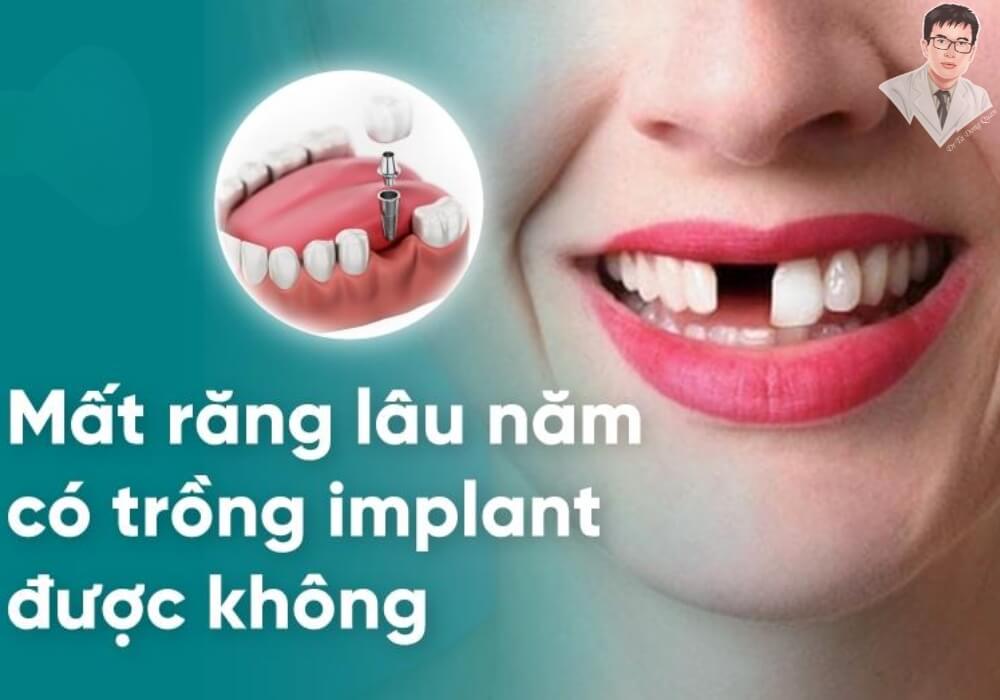 Hình ảnh minh họa cho câu hỏi mất răng lâu năm có trồng implant được không, với người bệnh đang lo lắng về việc phục hồi răng sau thời gian dài mất răng.