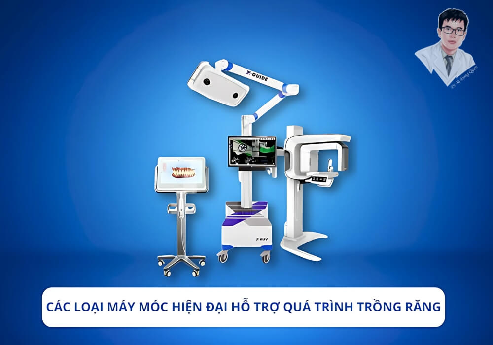 Các thiết bị hiện đại hỗ trợ trồng răng như máy chụp CT Cone Beam, phần mềm mô phỏng 3D và máy định vị cấy ghép.