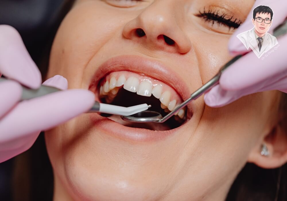 Hình ảnh bác sĩ nha khoa đang kiểm tra khoang miệng cho bệnh nhân sau khi nhổ răng, chuẩn bị đánh giá điều kiện trồng Implant đúng thời điểm. Hình ảnh bác sĩ nha khoa đang kiểm tra khoang miệng cho bệnh nhân sau khi nhổ răng, chuẩn bị đánh giá điều kiện trồng Implant đúng thời điểm.