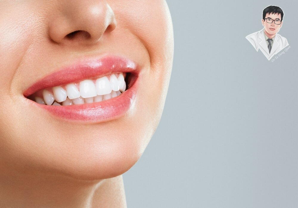 Gương mặt cười tươi của bệnh nhân sau khi phục hình răng bằng phương pháp cắm implant, thể hiện kết quả thẩm mỹ tự nhiên.