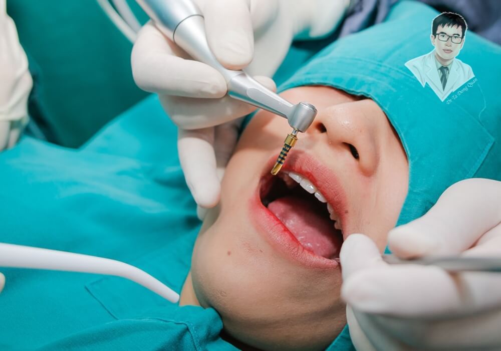 Bác sĩ thực hiện phẫu thuật cấy ghép implant trong điều kiện vô trùng.