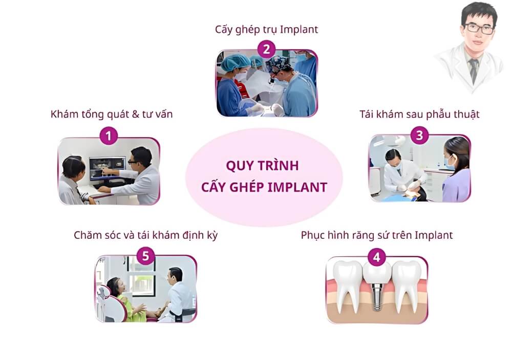  Mô phỏng chi tiết quy trình trồng răng implant gồm thăm khám, cấy ghép, phục hình và chăm sóc sau điều trị.