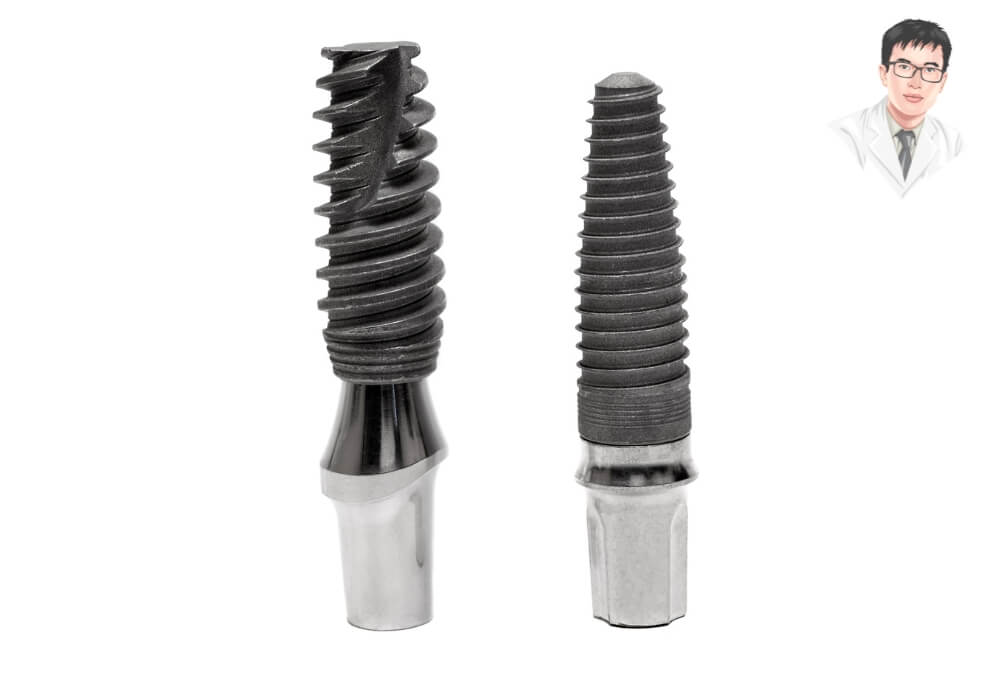 Review trồng răng Implant: So sánh trụ Implant Titan phổ biến – yếu tố quyết định độ bền, khả năng tích hợp xương và kết quả lâu dài sau phục hình. Hình ảnh cận cảnh hai loại trụ Implant titanium với thiết kế ren xoắn hiện đại, sử dụng trong phục hình răng mất bằng phương pháp cấy ghép Implant nha khoa.