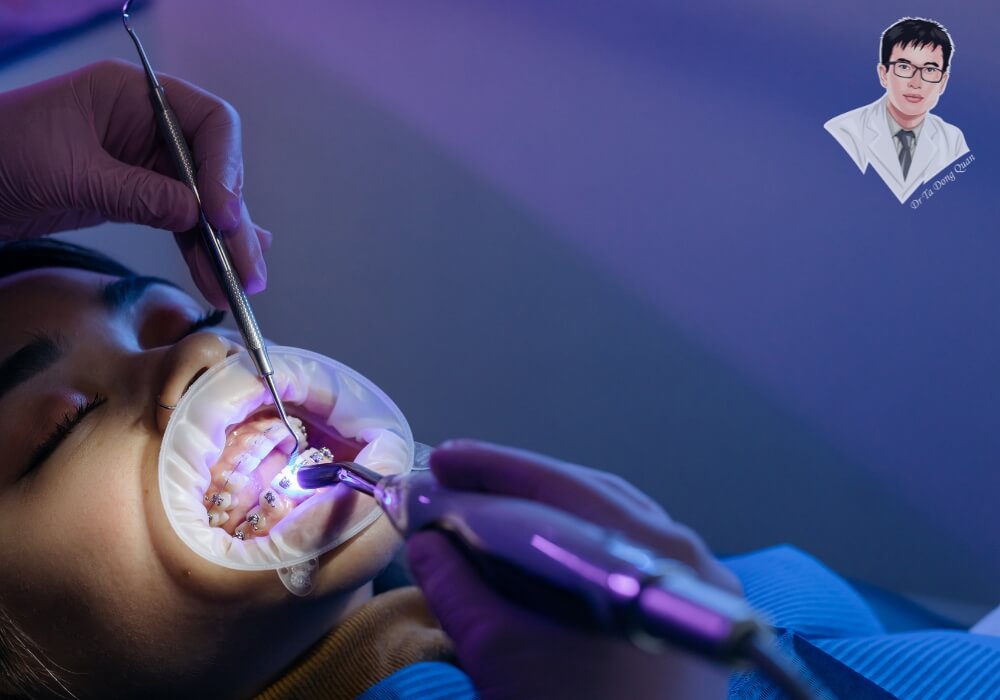 Bác sĩ nha khoa đang tiến hành điều trị răng cho bệnh nhân trong phòng khám hiện đại, sử dụng thiết bị chiếu sáng và dụng cụ chuyên dụng trong quy trình trồng răng Implant.