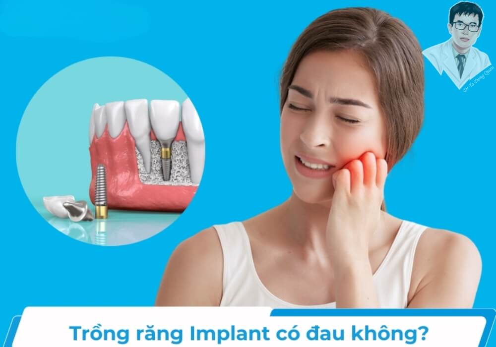 Người bệnh lo lắng, cơn đau sau khi trồng răng implant liệu có nghiêm trọng như bạn nghĩ?