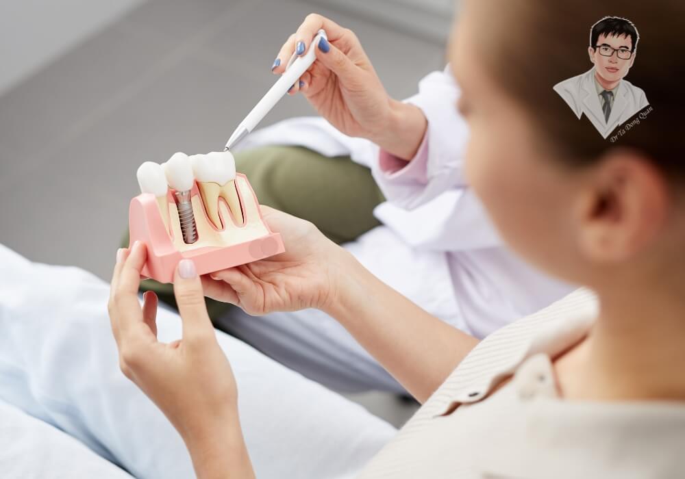 Bác sĩ tư vấn trồng răng Implant chi tiết và dễ hiểu – Giúp bạn yên tâm trước khi điều trị. Hình ảnh bác sĩ nha khoa đang tư vấn trồng răng implant bằng mô hình trực quan cho bệnh nhân.