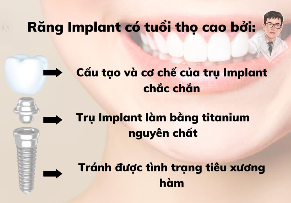 : Infographic giải thích lý do răng Implant có độ bền cao: cấu trúc vững chắc, vật liệu Titanium nguyên chất và ngăn ngừa tiêu xương hàm