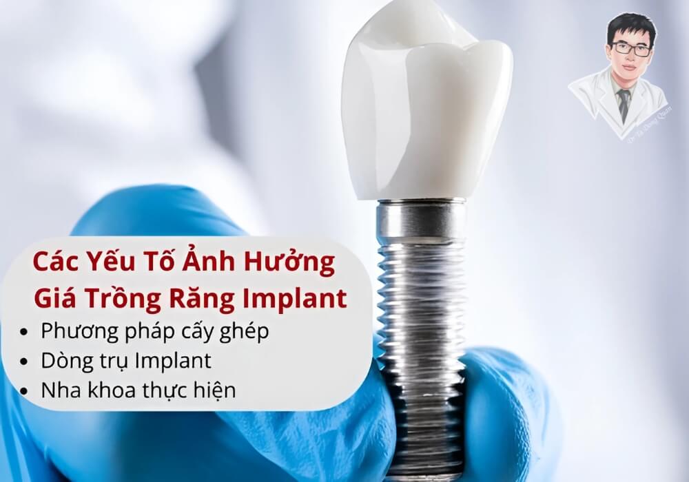 Các yếu tố ảnh hưởng đến chi phí trồng răng implant, bao gồm loại trụ, phương pháp và nha khoa thực hiện.