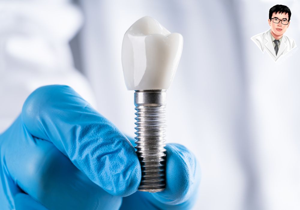 Trụ titanium chuẩn bị cấy vào xương hàm – vật liệu an toàn và bền bỉ.