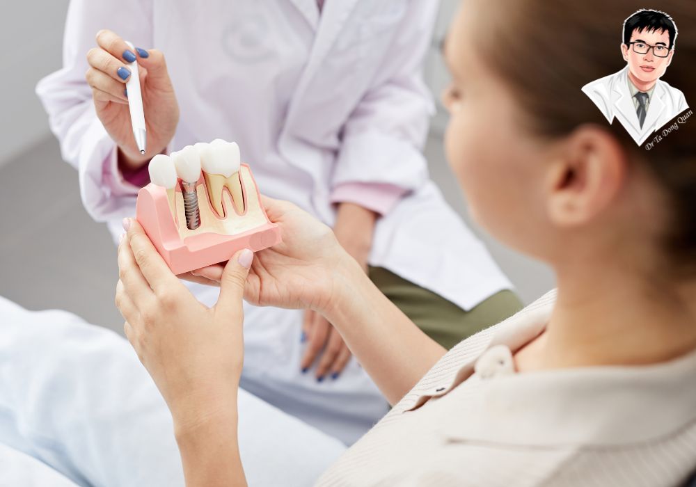 Tư vấn giúp bệnh nhân hiểu rõ quy trình cấy implant và các lựa chọn trụ phù hợp